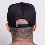 scar tissue snapback