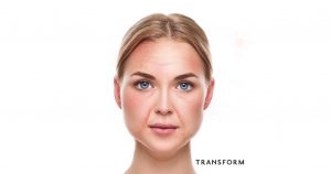How to look after your skin and where you are going wrong 4 diet impact on skin