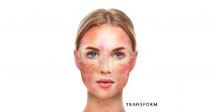 How to look after your skin and where you are going wrong 5 over exfoliation impacts on skin