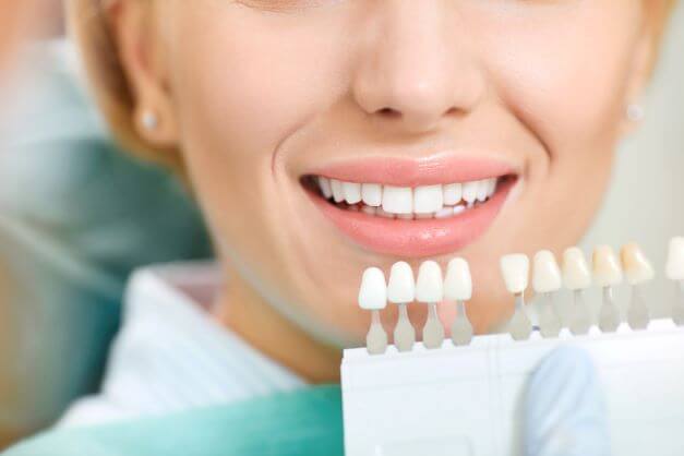 range of Dental Implants colours