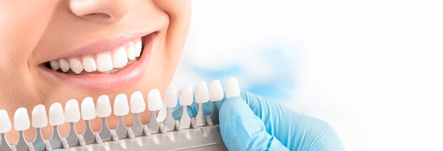 smiling white teeth at dentist